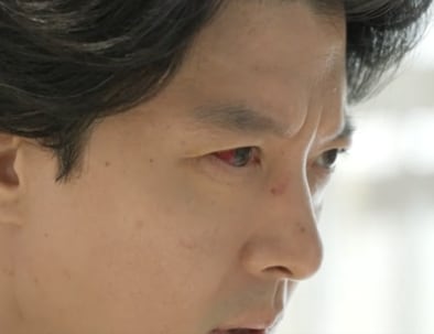 배우 이동건이 강직성 척추염을 진단받았다. 강직성 척추염 환자 대부분은 눈이 충혈되는 포도막염을 첫 증상으로 경험한다고 한다. /SBS '미운 우리 새끼'