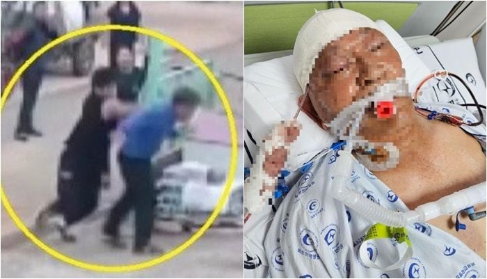 작년 10월 어머니와 다투던 70대 마을 주민에게 주먹을 휘두르는 A(16)군의 모습, 병원으로 옮겨진 피해자의 모습. /JTBC '사건반장', 연합뉴스