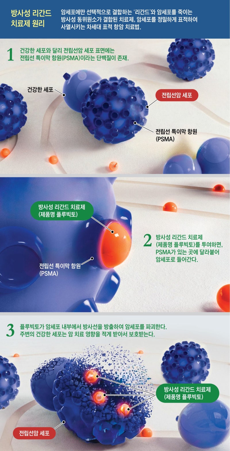 암세포만 저격하는 ‘방사선 미사일 치료’가 뜬다