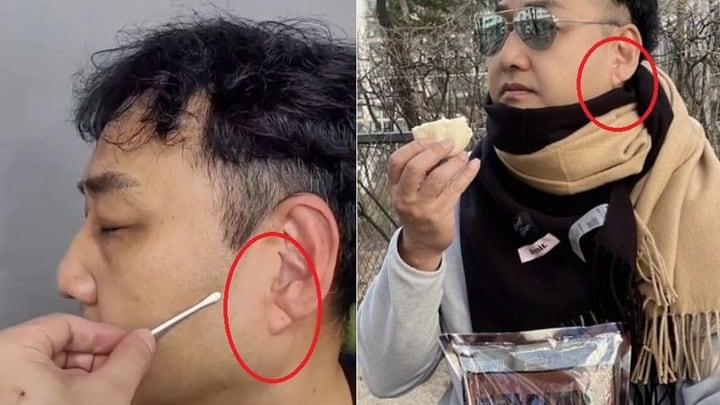 귓불 주름부터 탈모까지 몸이 보내는 질병 경고들