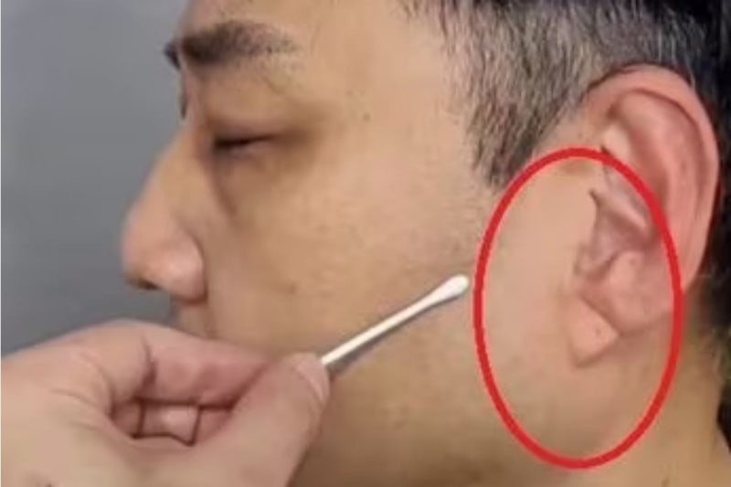 “<b>김수용 귓불주름</b>은 <b>노화</b> 현상”… 흉부외과 교수가 밝힌 심근경색 전...