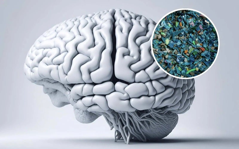 미세 플라스틱이 사람 뇌에 퍼져있다고?