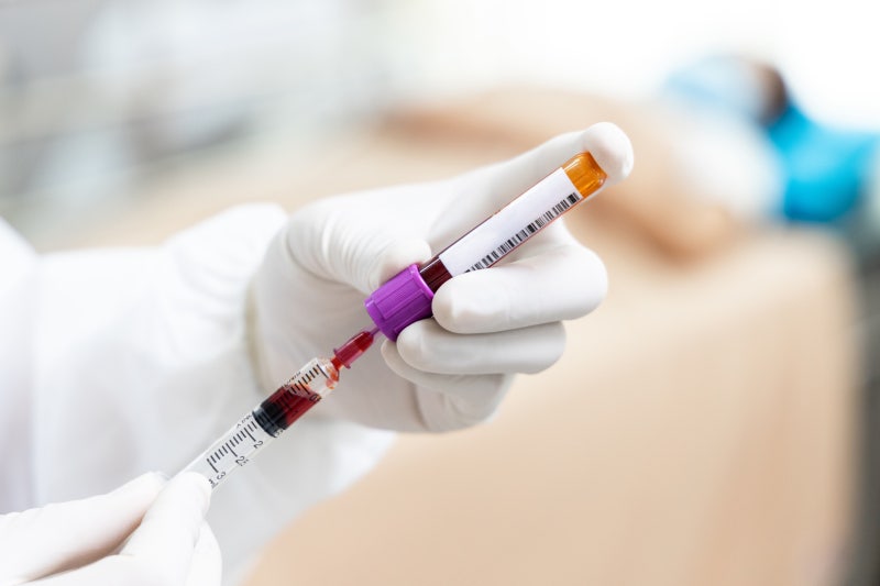 혈압·당뇨보다 많다, 성인 4명 중 1명 고지혈증