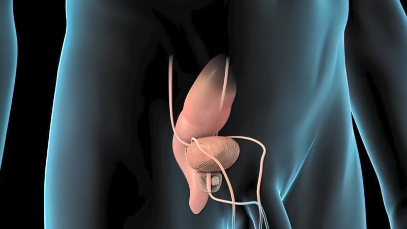 식습관 서구화에 전립선암 늘고 남성 흡연율 낮아져 폐암은 감소