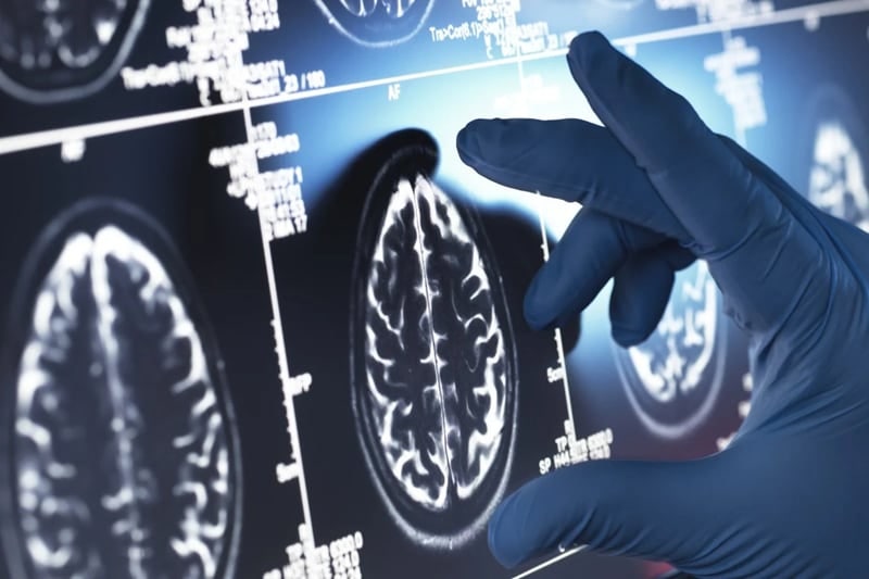 중국이 국가 주도로 2030년까지 치매 조기 스크리닝, 진단 및 치료 개선을 목표로 하는 프로젝트를 가동하고 있다고 네이처지가 24일 보도했다. /Getty Images