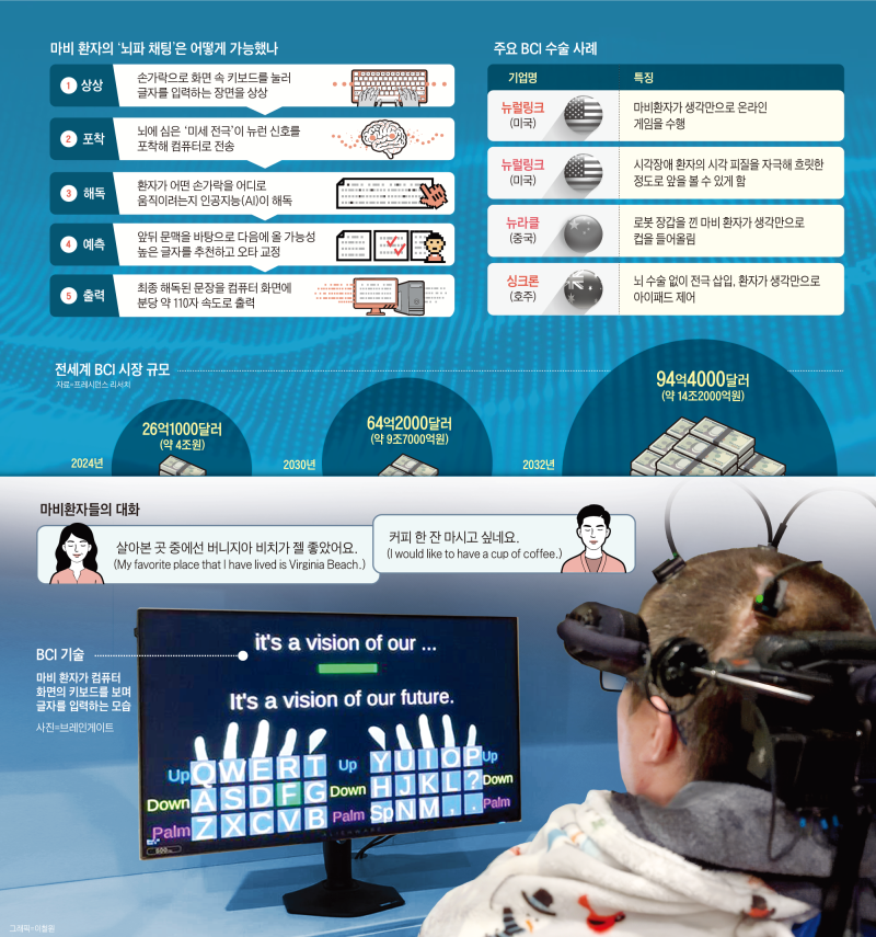 '꿈의 기술' BCI, 일반 환자에 적용 눈앞 - 뉴스 썸네일 이미지