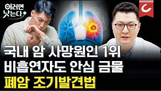 요즘 폐암 환자의 40%는 비흡연자… 요리 자주 한다면 저선량 CT 찍어봐야