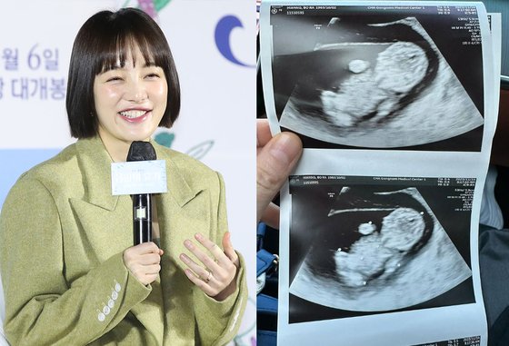 지난해 임신에 성공한 소감을 전했던 배우 황보라. 사진 뉴스1·황보라 인스타그램