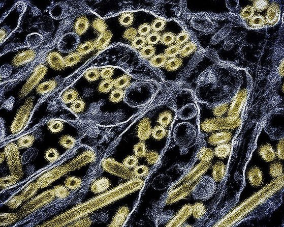현미경으로 본 A형 인플루엔자의 하위종인 H5N1 바이러스. AFP=연합뉴스