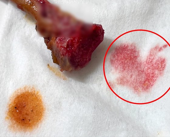 베어 문 닭다리에서 흘러나온 피. 왼쪽 아래의 치킨 양념과는 색깔이 다르다. 연합뉴스=독자제공