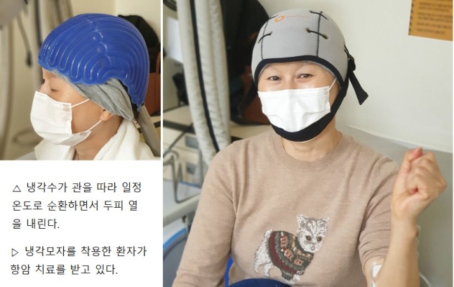 항암치료 중인 암 환자가 탈모 방지를 위한 냉각모자를 쓴 모습. 사진 삼성서울병원