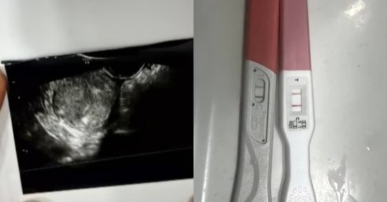 "누나 인생 망치게 한 것 같아"…'낙태 강요' <b>야구선수</b> 녹취 공개