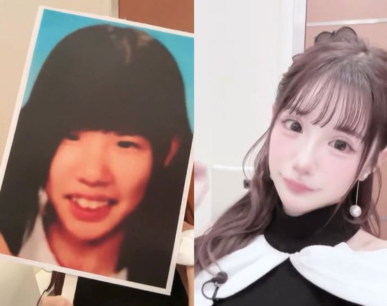 히라세 아이리의 성형 전(왼쪽) 모습과 성형 후 모습. 사진 히라세 아이리 인스타그램 캡처