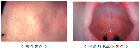 사진 미국질병관리본부=질병청