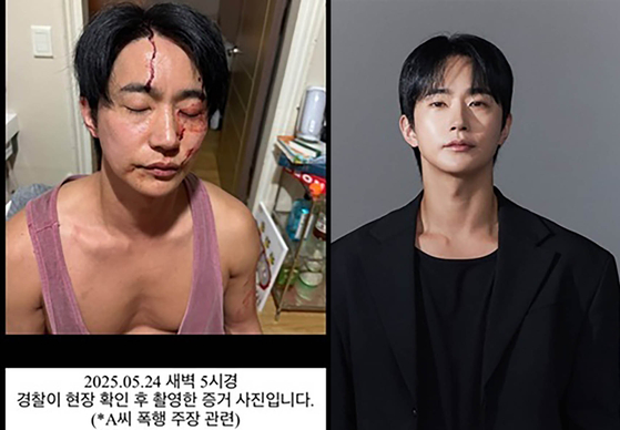 뮤지컬 배우 전호준은 25일 자신의 인스타그램에 전날 일어난 연인과의 폭행 사건 관련 자신이 피 흘리고 있는 모습의 사진(왼쪽)을 공개했다. 사진 전호준 인스타그램 캡처