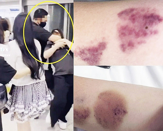 걸그룹 하츠투하츠 경호원이 공항에서 한 여성을 저지하고 있는 모습(왼쪽)과 이 여성이 공개한 폭행 피해 사진. 사진 틱톡·엑스 캡처