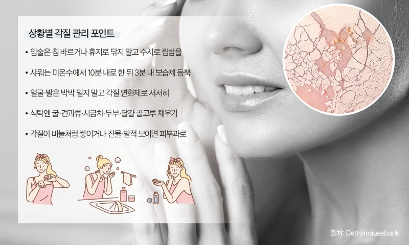 등산 후 사우나 삼가세요…'각질 폭탄' 만드는 나쁜 습관들 [Health&]