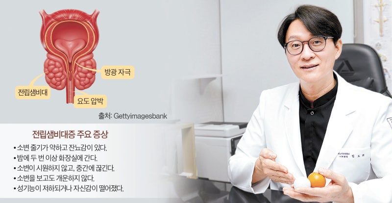 커진 전립샘, 수술하면 성기능 더 떨어진다? 부작용 오해와 진실 [Health&]