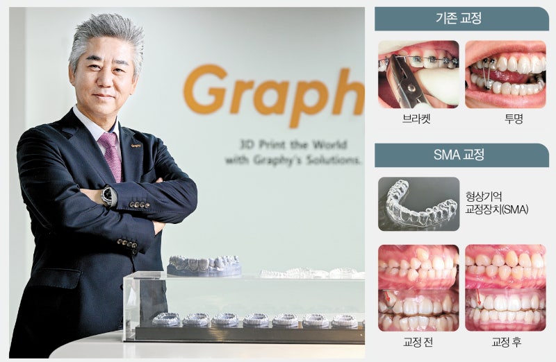 "형상 복원 투명 소재로 안 아프게 교정, 치료 패러다임 바꿔" [Health&]