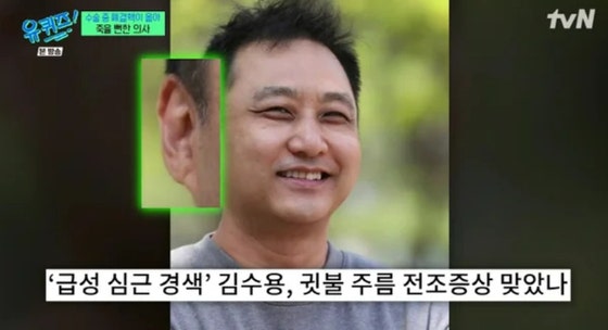 <b>김수용 귓불 주름</b>이 심근경색 전조증상?…전문의 "<b>노화</b> 현상"