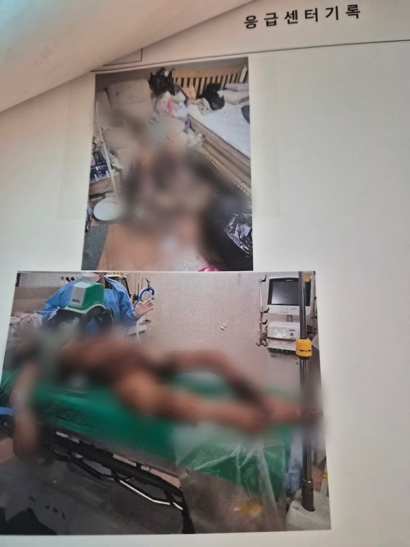 [단독] “수사 한 거 맞나”…구더기 사망 유족이 찾아낸 끔찍 증거