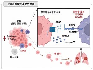 삼중음성유방암 전이 상태.사진 서울대병원
