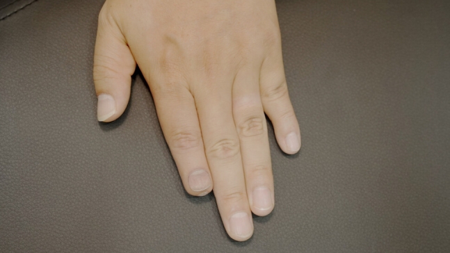 사고로 손가락을 잃은 의뢰인의 검지 손 마디에 그려진 손톱 모양의 타투.