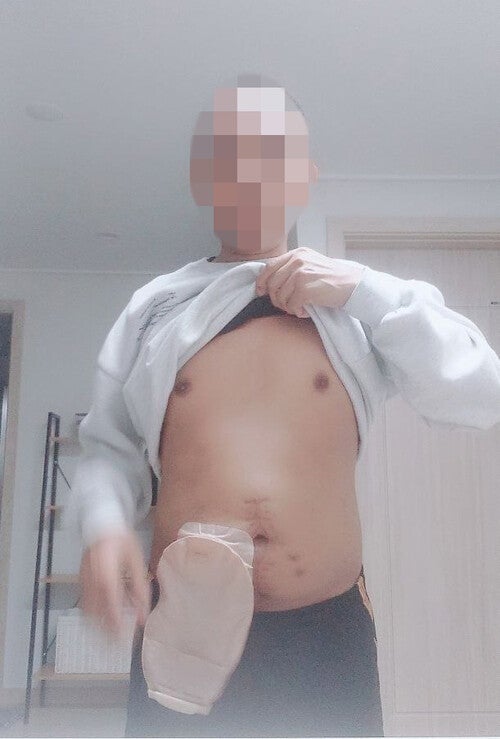 [단독] 에어건 장기손상 피해자 “사장, 평소에도 폭력…싫다하면 더 심하게 괴롭혀”