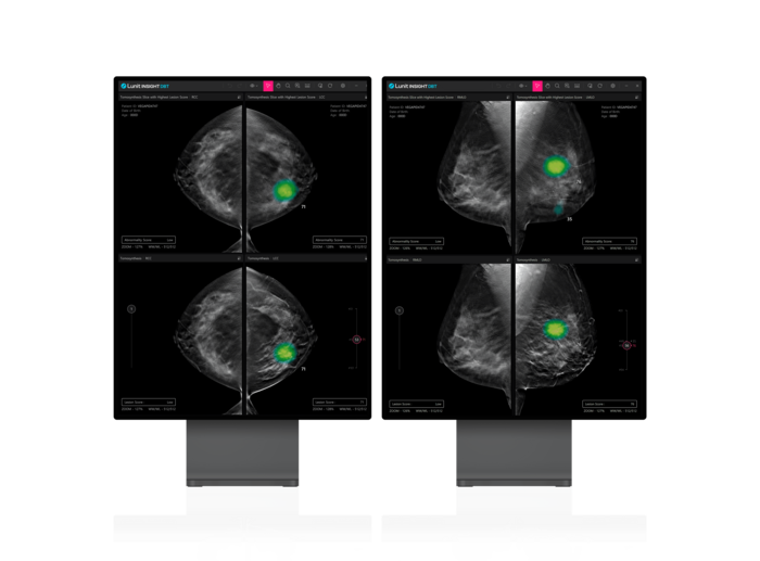 <b>루닛</b>, 3D 유방암 검진 '<b>루닛</b> 인사이트 DBT' 美 FDA 승인 획득