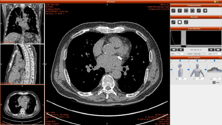 0003371800_001_20251119125617727.png?type=w800