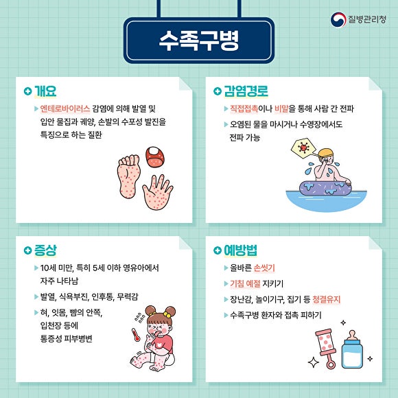 대구 달성군보건소, 영유아 수족구병 증가 ‘위생수칙 준수’ 당부