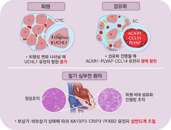 서울아산병원 연구팀이 심근병증 발병에 관여하는 유전자를 찾아냈다.[사진=서울아산병원]