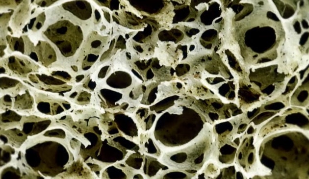 사진은 골다공증 이미지로,본 기사 내용과 무관.[사진=EBS]