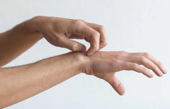 "벅벅 긁어도 가렵고 따가워"⋯'이 차' 먹으면 독소·노폐물 싹 빠져나와 해결