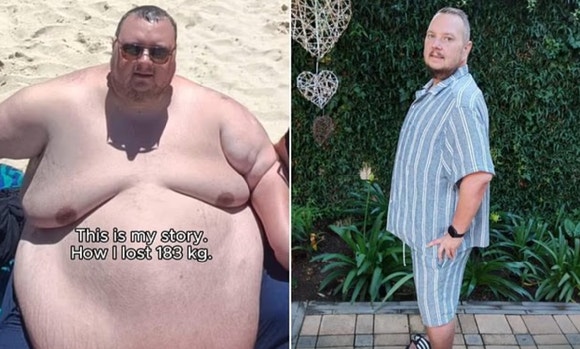 [헬스+] "40세 못 넘긴다" 당뇨·고혈압 앓던 300㎏男⋯'이 방법'으로 200㎏ 감량