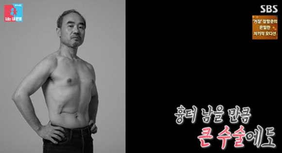 "빚 때문에 수술 2주만에 <b>촬영</b> 강행"…배우 <b>강신일</b>, 47세 때 '<b>간암</b> 투병...