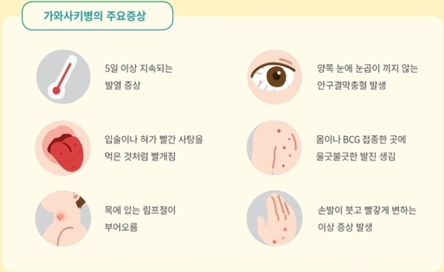 가와사키병의 주요 증상. 인천성모병원 제공