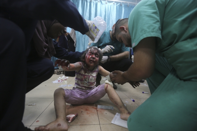 8일(현지시간) 이스라엘군의 인질 구출 작전으로 부상을 입은 한 어린이가 알아크사 병원에서 치료를 받고 있다. AP연합뉴스