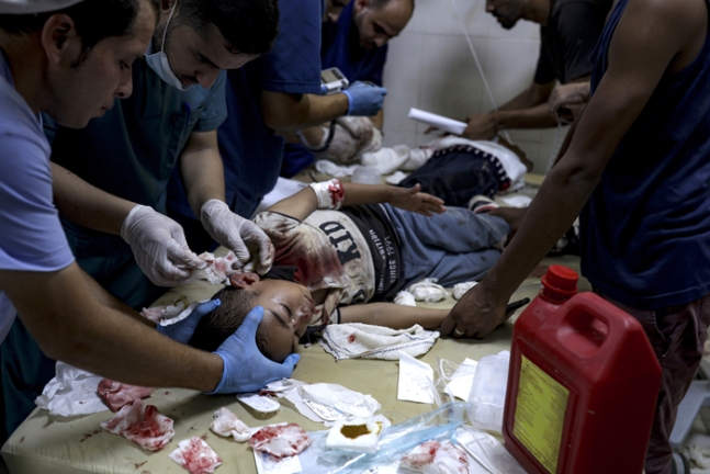 9일(현지시간)  가자지구 남부 칸유니스의 병원에서 이스라엘군의 유엔 학교 공습으로 부상을 입은 아이가 치료를 받고 있다. AP연합뉴스