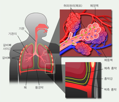 호흡기의 구조.기관지흉막루는 기관지와 흉막 사이에 비정상적인 누공(구멍)이 생기는 질환이다.보건복지부 제공