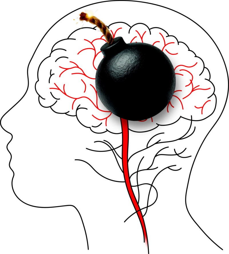 아버지·할아버지에게 생기는 병인 줄 알았는데 ···뇌졸중, '2030 여성'을 노린다