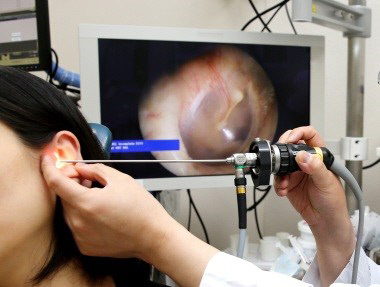 이비인후과 전문의가 환자의 중이염 여부를 살펴보기 위한 검사를 진행하고 있다.경향신문 자료사진