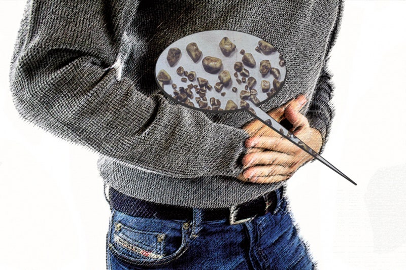 너무 덜 먹어도, 너무 확 먹어도, 담낭 ‘돌’ 볼 위험