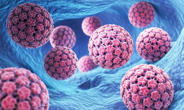 <b>HPV</b> 감염이 주요 원인인 ‘이 암’···<b>바이러스</b> 유전자형 따라 생존율...