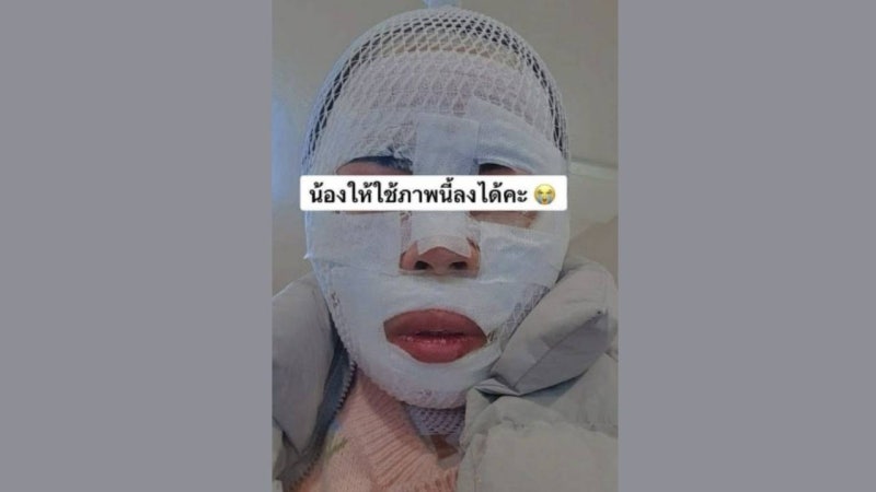 못생기게 만들겠다며 <b>아내</b> 얼굴에 <b>끓는 물</b> 부은 남성, "실수였다"
