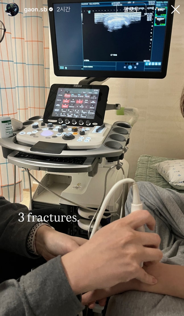뼈 부러진 채 금메달 땄나...최가온, SNS에 "3곳 골절"