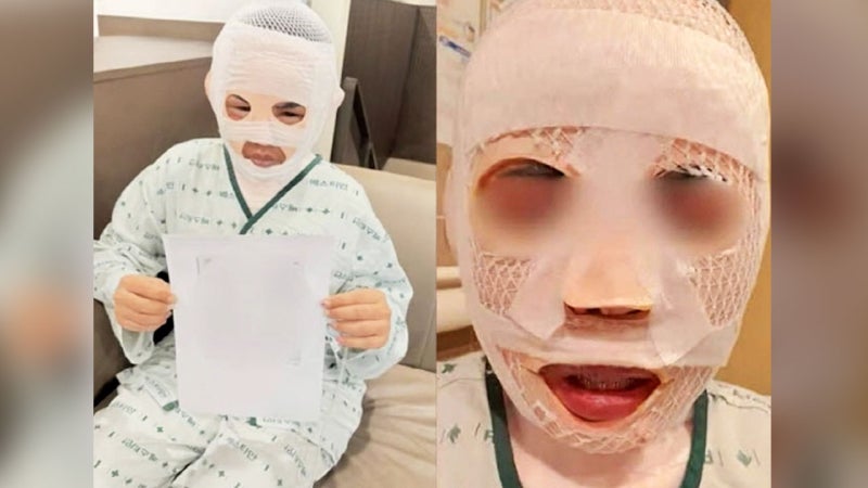 <b>태국인 아내</b> 얼굴에 <b>끓는 물</b> 부은 40대 한국인…경찰 수사