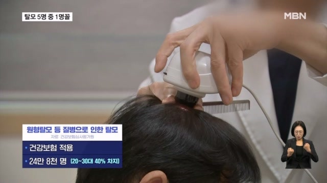 국민 5명 가운데 1명이 탈모 고민…건강보험 적용 어디까지?