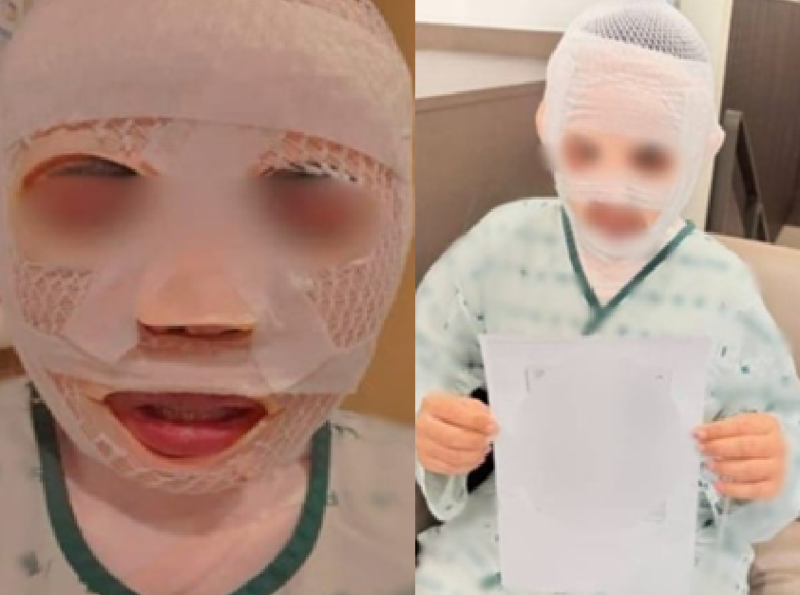 잠든 태국인 아내 얼굴에 끓는 물을 부은 40대 한국 남성이 경찰에 붙잡혔다.사진은 피해 태국인 여성./ 사진=SNS