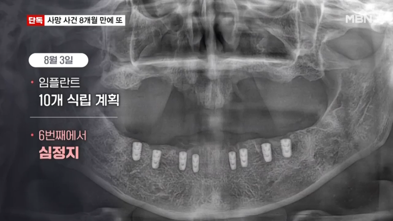 사진 = MBN뉴스7 방송 화면